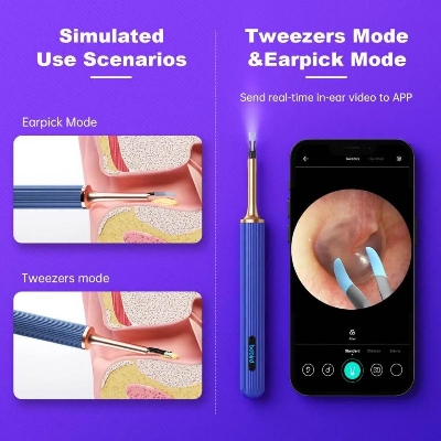 Picture of BEBIRD Note3 Pro Max 10 Megapixel HD All-in-1 Ear Wax Removal with Camera