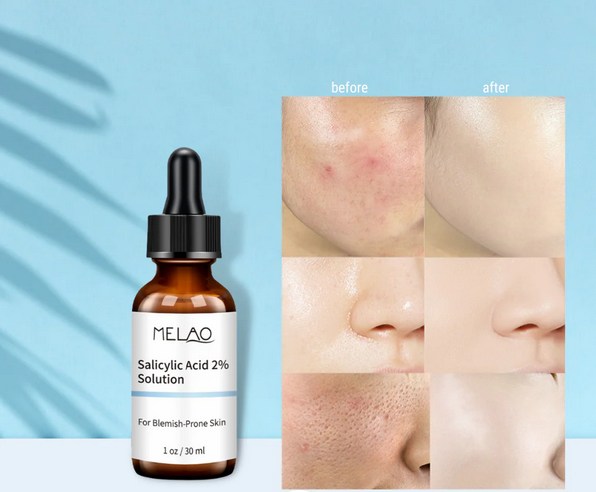 Buy Melao- Salicylic Acid Serum 2% Concentrate For Face -30ml  at Best Price In Bangladesh