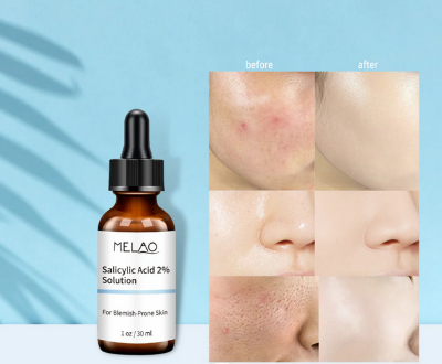Buy Melao- Salicylic Acid Serum 2% Concentrate For Face -30ml  at Best Price In Bangladesh