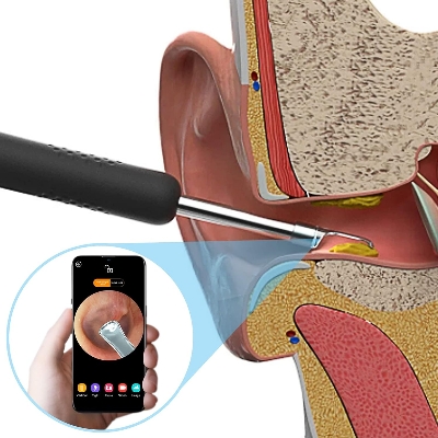 Picture of Xiaomi Bebird R1 Wireless Intelligent Visual Ear Stick Precision Endoscope