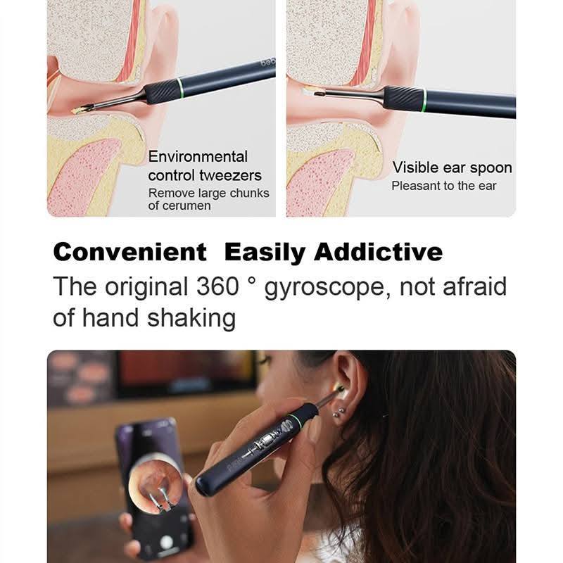 Picture of Xiaomi Bebird Note 5 Pro Ear Cleaner Smart Visual Ear Sticks, 10 Megapixel HD Otoscope with Light-Blue