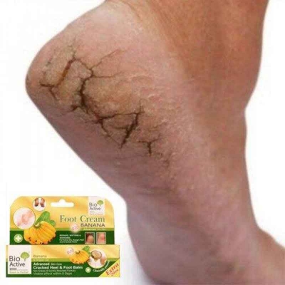 Picture of BIO ACTIVE BANANA & ARGAN OIL CRACKED HEEL & FOOT BALM 30ML