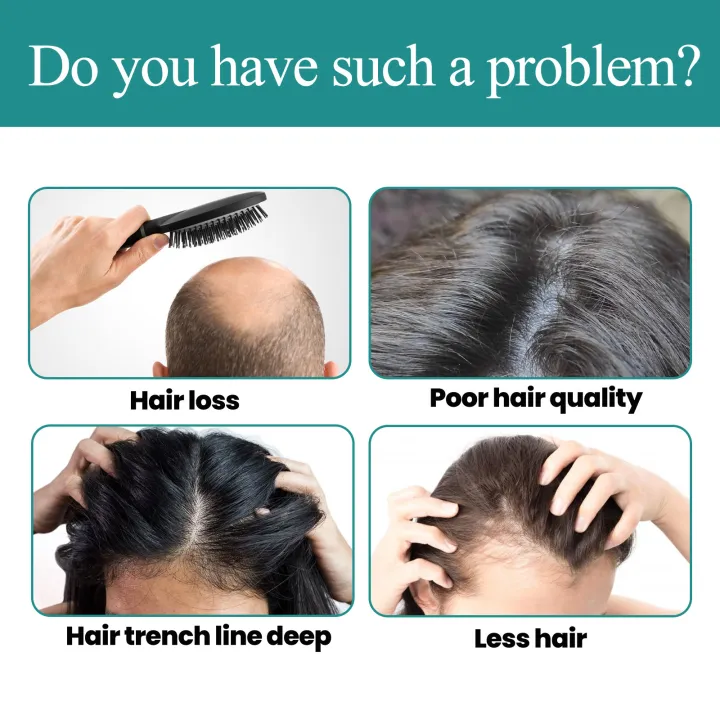 Picture of Eelhoe Biotin Fast Hair Growth Oil Hair Regrowth Serum Prevent Baldness Scalp Massage Treatment Hair Growth Liquid Anti-Hair Loss for Women and Men Dense Hair Growth Serum Dry Damaged Hair Care Essential Oil（45ml）