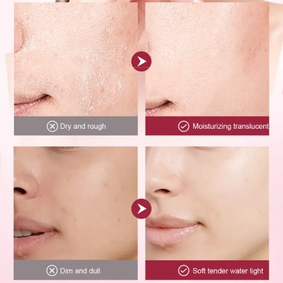 Picture of SADOER Azelaic Acid Luxurious Essence Moisturizing Shrink Pores Refreshing Skin Beauty Essence 30ml