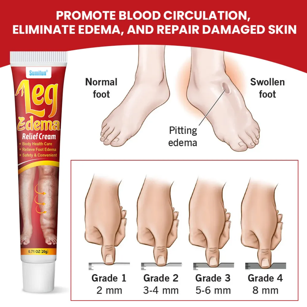 Picture of Sumifun Leg Edema Relief Cream 20g
