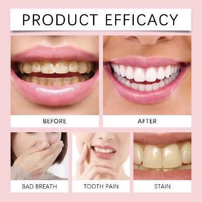 Picture of Oralhoe SP-6 Brightening + PROBIOTICS Bright White Toothpaste