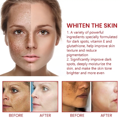 Picture of Ouhoe Dark Spot Cream 30ml