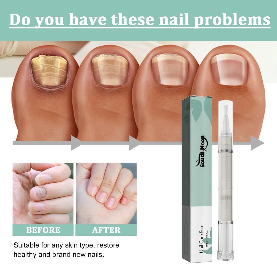 Picture of South Moon Nail Care Pen