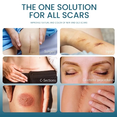 Picture of Sumifun Scar Gel, 30g