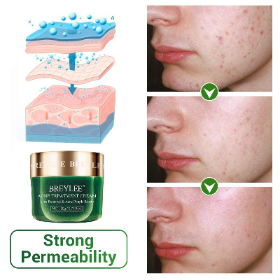 Buy BREYLEE Acne Treatment Cream 20g at Best Price In Bangladesh