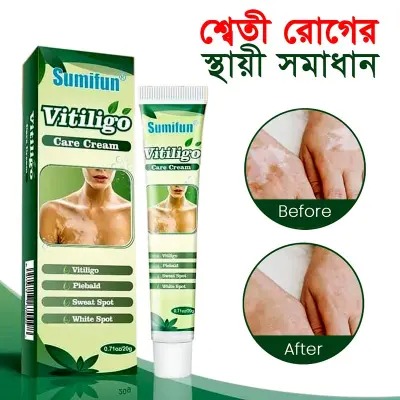Picture of Sumifun Vitiligo Treatment Ointment Cream- 20g