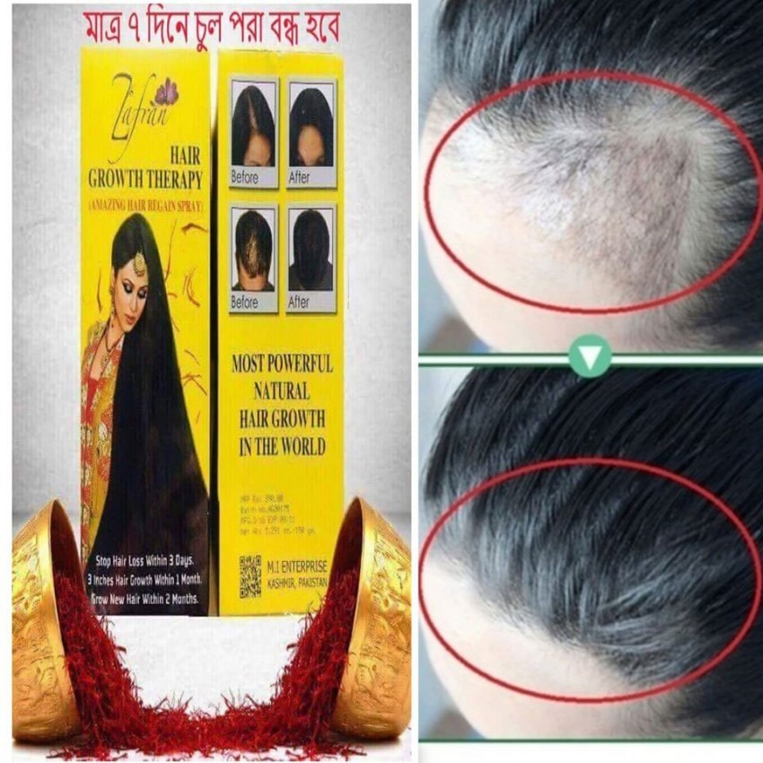 Picture of Zafran Hair Growth Therapy Oil / Regan Spray 150ml