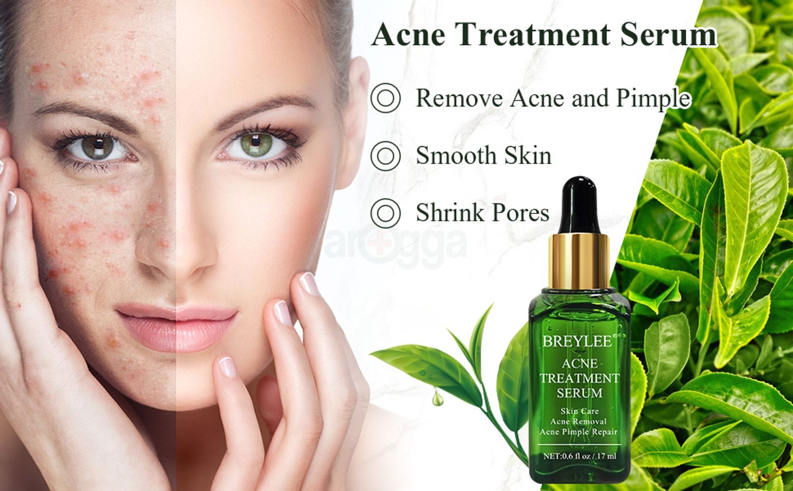 Picture of Breylee Acne Treatment Serum- 17ml