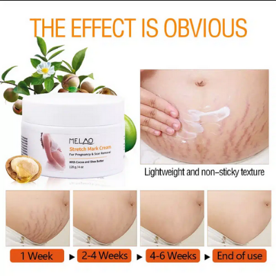Picture of Melao Stretch Mark Cream 120gm For Pregnancy And Scar Removal Treatment With Cocoa And Shea Butter Belly Moisturizer