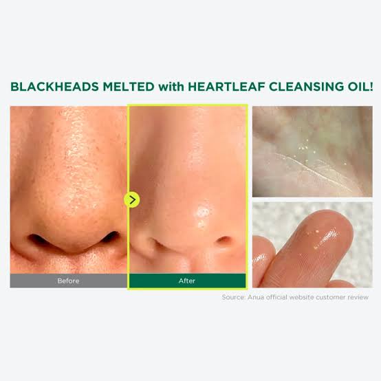 Picture of Anua Heartleaf Pore Control Cleansing Oil-200ml