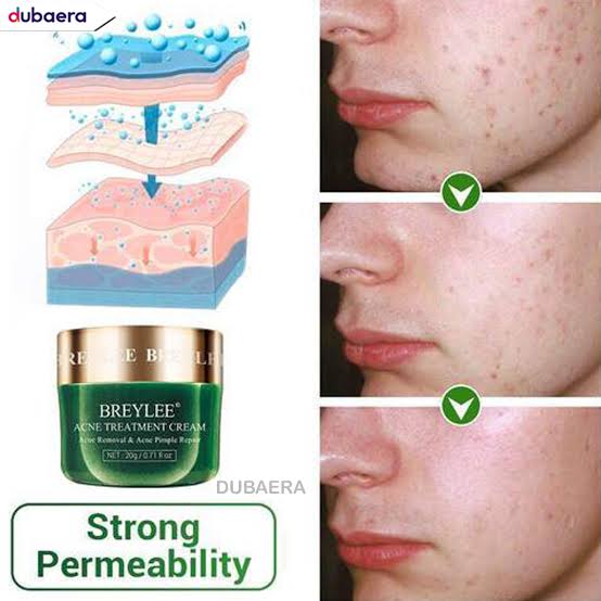 Picture of BREYLEE Acne Treatment Cream 20 gm