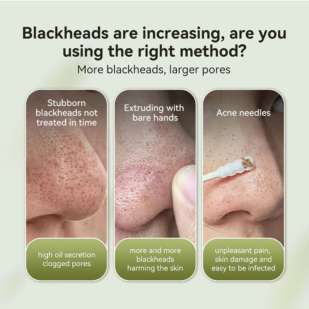 Picture of Lanbena Nose Plants Strips 2% BHA Mask Box - 30g