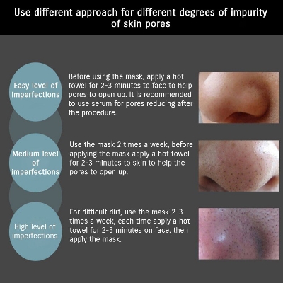 Picture of Blackhead Remover Black Spots Mask Nose Pilaten Acne Purifying Peel Off Charcoal Deeply Cleanses Pores Skin