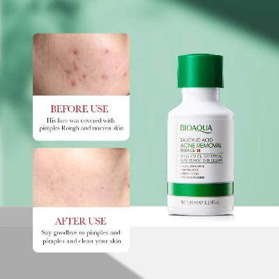 Picture of BIOAQUA Salicylic Acid Acne Removal Essence- 35ml