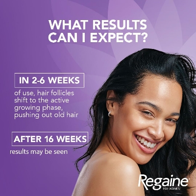 Picture of Female Minoxidil Rogaine Topical Solution Hair Regrowth Treatment 2% Minoxidil for Women - 60 ml 30 Days Supply with Derma Roller Combo