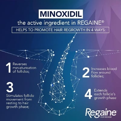 Picture of Female Minoxidil Rogaine Topical Solution Hair Regrowth Treatment 2% Minoxidil for Women - 60 ml 30 Days Supply with Derma Roller Combo