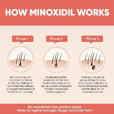 Picture of Kirkland Signature Topical Minoxidil 5% Extra Strength for Men Hair Regrowth Treatment - 1 Month Supply