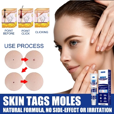 Picture of Warts & Skin Tag Remover Ointment: Treatment Cream