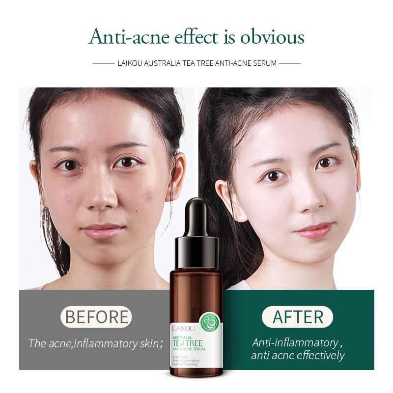 Picture of Laikou Australian Tea Tree Serum – 17ml
