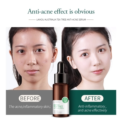 Picture of Laikou Australian Tea Tree Serum – 17ml