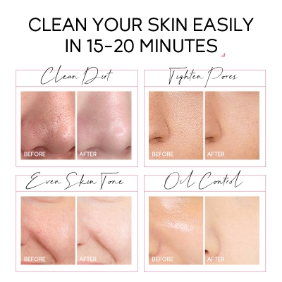 Picture of Laikou Japan Sakura Peel off Mask 50gm - Deep Cleansing Tighten Pores Even Brighten Skin Tone Blackhead Remover