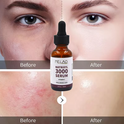 Picture of MELAO MATRIXYL 3000 Serum Vitamin C Hyaluronic Acid 30ml/1fl.oz