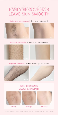 Picture of LAIKOU Japan Sakura Hair Removal Cream - 50g