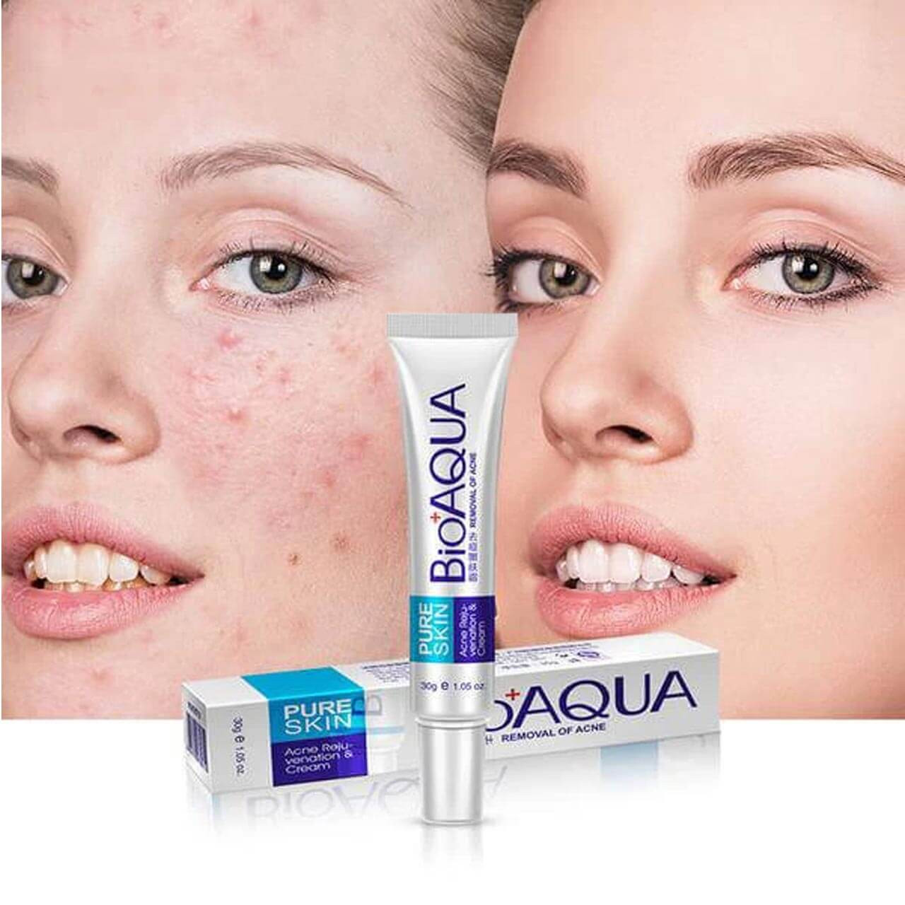 Picture of Pure Skin Acne Rejuvenation & Cream - 30g