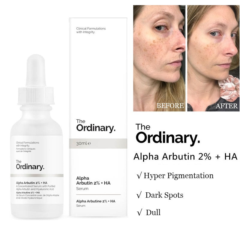 Picture of Alpha Arbutin 2% + HA (30ml)