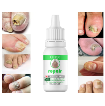 Picture of Repair Nail Fungus Treatment Serum Toe Fungal Repair Products Hand Foot Care Removal Gel Anti Infection Onychomycosis Paronychia