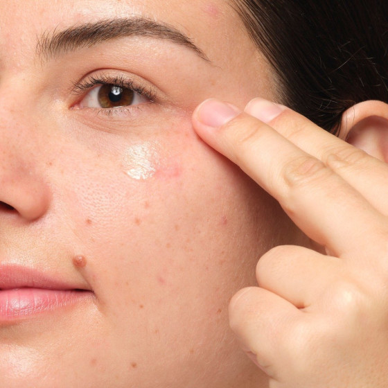 Picture of The Ordinary Multi Peptide Eye Serum 15 ml