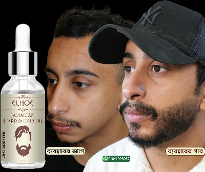 Picture of ELHOE Jamaican Beard and Hair Growth Oil – 100% Natural, Powerful, and Safe Natural Castor Oil With Good Benefits