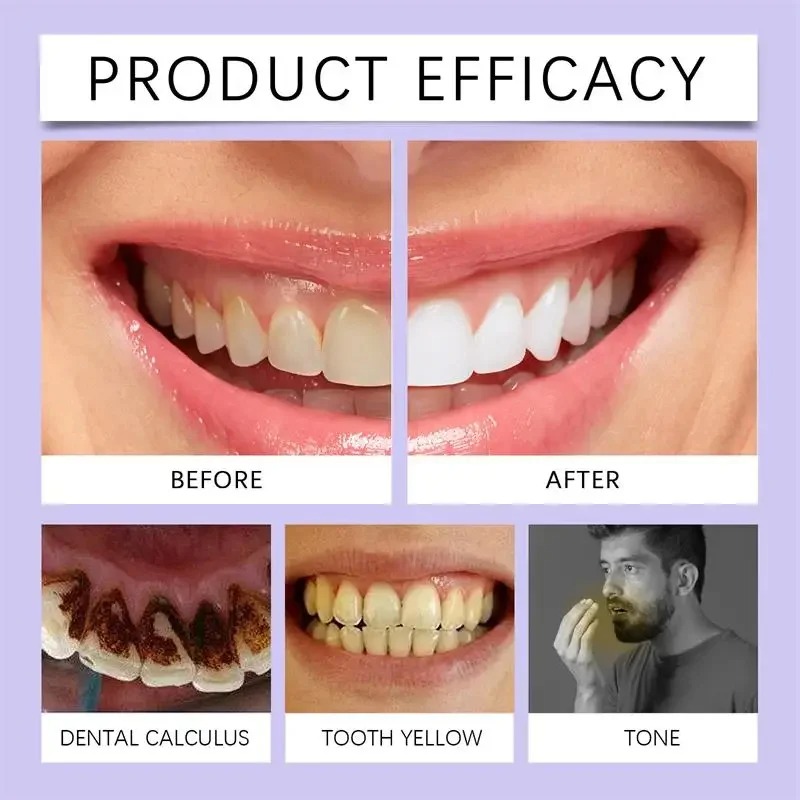Picture of ELHOE Teeth Whitening Toothpaste – 100% Natural Herbal Formula – Instantly Whitens Teeth, Removes Yellow Stains, Fights Plaque & Bad Breath – Strengthens Enamel – Fluoride-Free & Safe for Sensitive Gums – Daily Oral Care Toothpaste for Men & Women