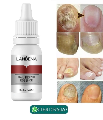Picture of Lanbena Nail Repair Essence Serum Fungal Treatment Damaged Nails, Protects from Infection, Discoloration 15ML