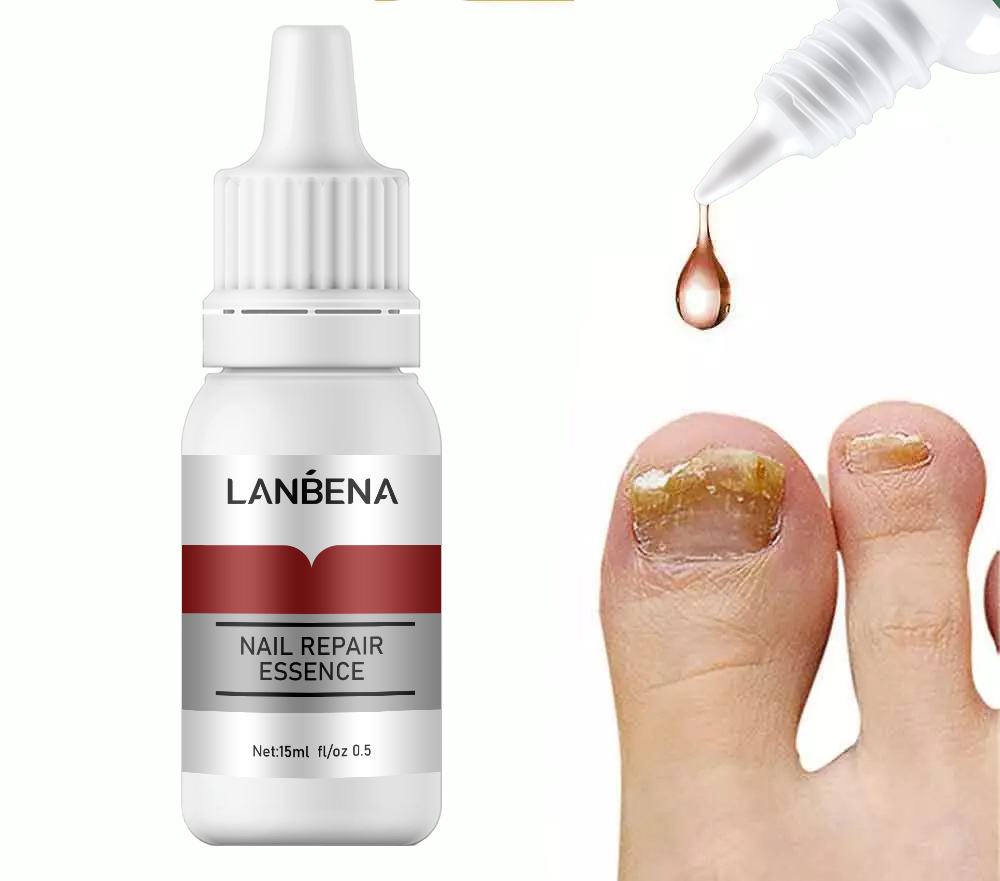 Picture of Lanbena Nail Repair Essence Serum Fungal Treatment Damaged Nails, Protects from Infection, Discoloration 15ML