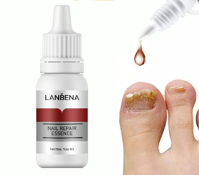 Picture of Lanbena Nail Repair Essence Serum Fungal Treatment Damaged Nails, Protects from Infection, Discoloration 15ML