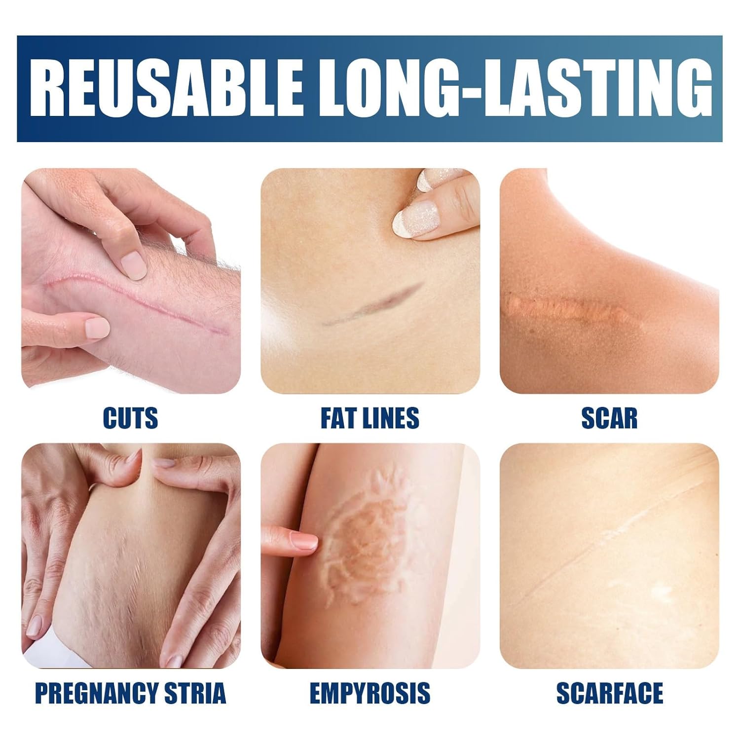 Picture of ELHOE Scar Removal Cream Gel Burn Surgical Scar Cesarean Scar Repairing Stretch Marks Pigmentation Corrector