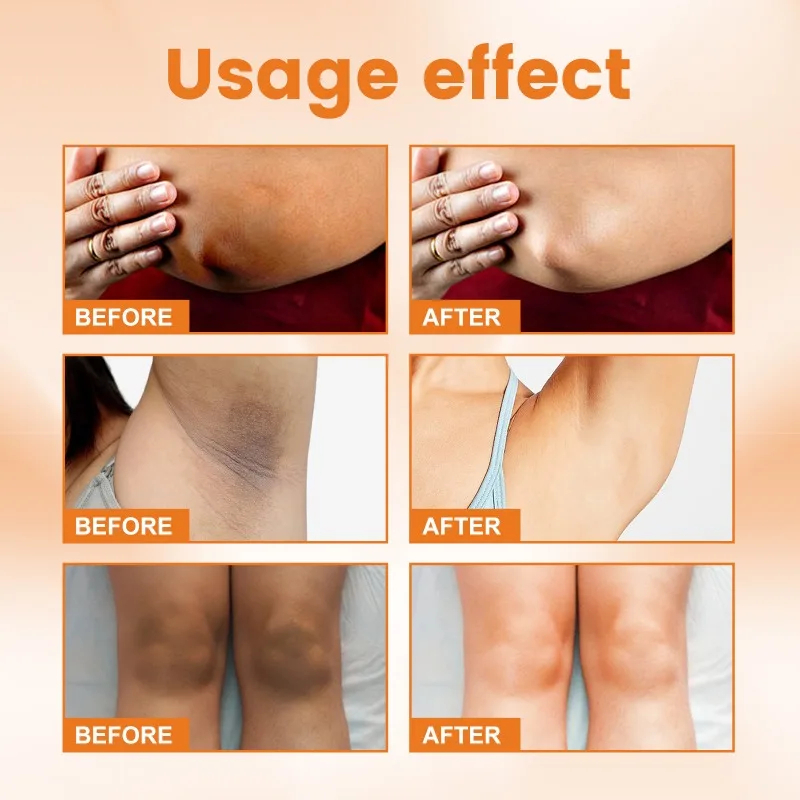 Picture of LANBENA Skin Face and Underarm Whitening serum for men and women Retinol EELHOE Face Serum