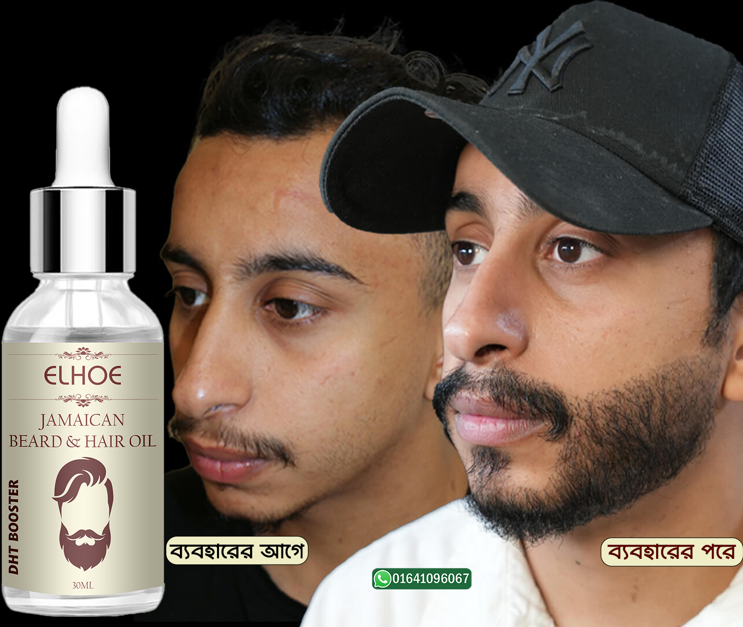 Picture of ELHOE Jamaican Beard and Hair Growth Oil – 100% Natural, Powerful, and Safe