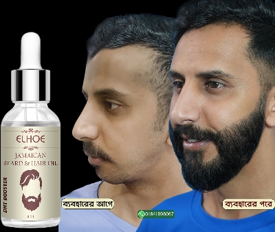 Picture of ELHOE Jamaican Beard and Hair Growth Oil – 100% Natural, Powerful, and Safe