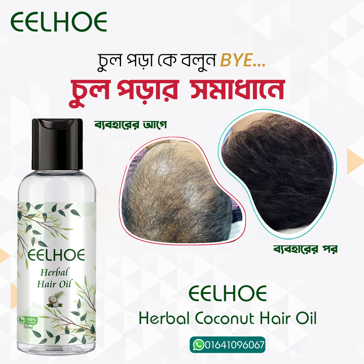 Picture of EELHOE Herbal Hair Oil Herbal Essences Pure Hair Oil Blend Coconut & Aloe Hair Serum Smoothing Soften Repair Anti-Dandruff Hair Frizz Oi Essential Scalp Damaged Treatment Hair Products
