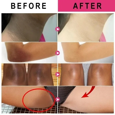 Picture of EELHOE Silicone Gel For Underarm and Dark Skin Areas EELHOE Lightening Serum