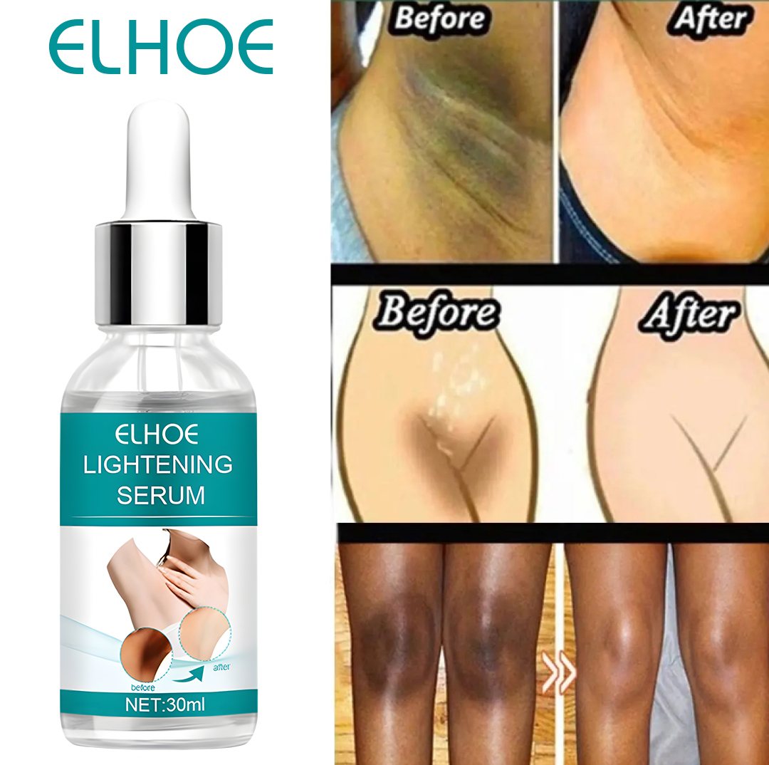 Picture of EELHOE Dark Underarm Brightener Professional Quality Korean Skin Darkness Remover