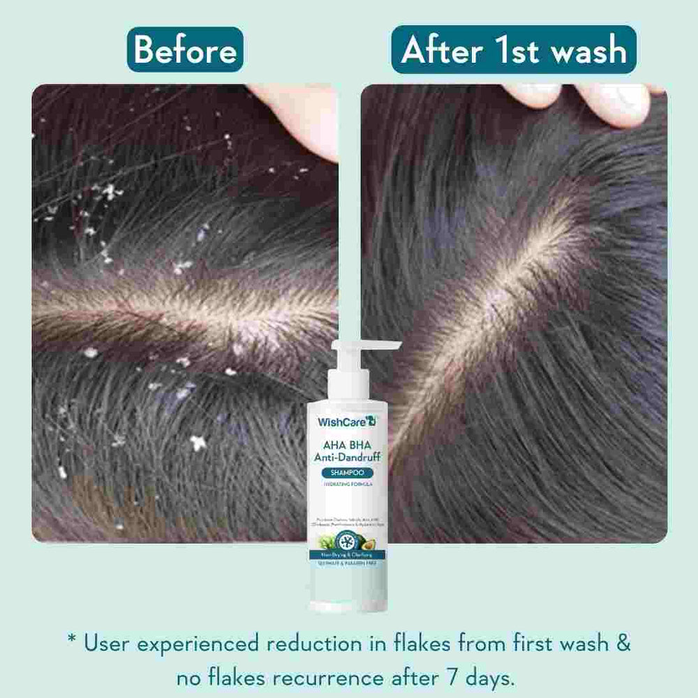 Picture of WishCare AHA BHA Anti-Dandruff Shampoo 250ml