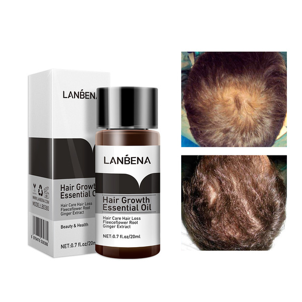 Picture of Hair Growth Essence Essential Oil Liquid Treatment Preventing Hair Loss Hair Care20ml